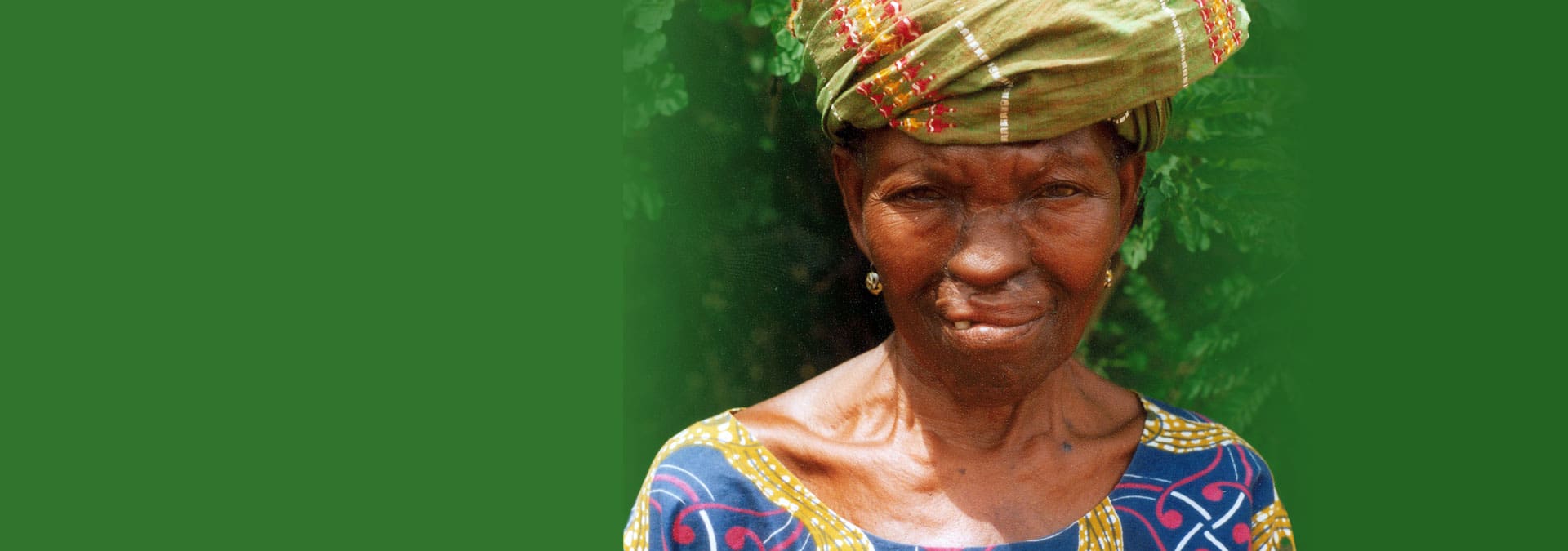 2000
Felisia, Benin
2000 · Dignity restored
After living without a nose for more than 50 years, Felisia returned home holding her head high.