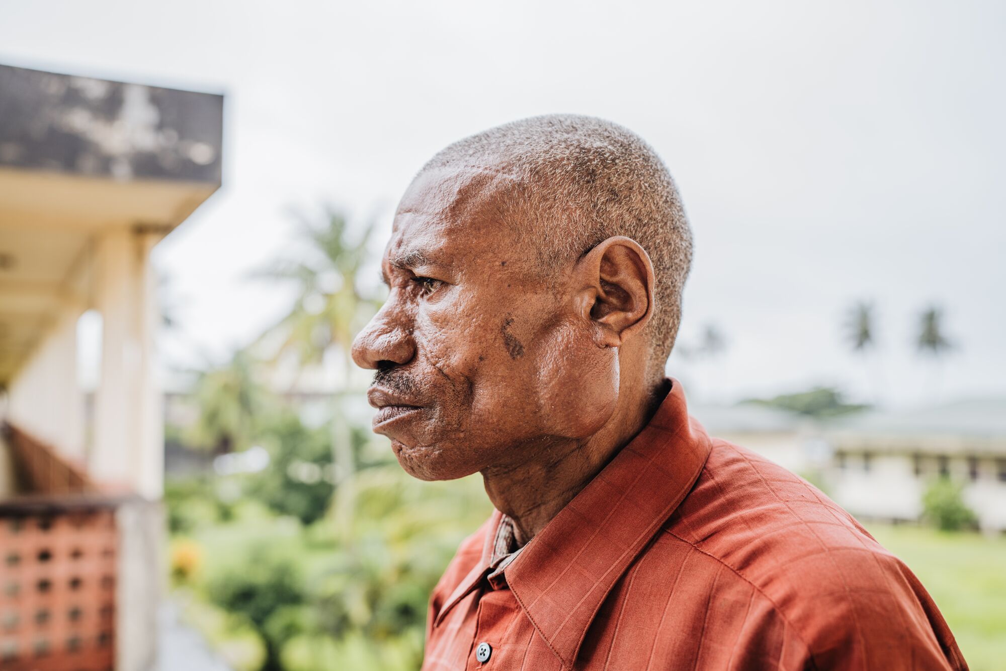 For decades, Désiré lived with a condition he couldn't afford to have treated, making everyday movement increasingly difficult.